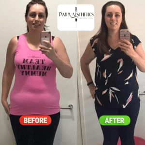 results gallery img 1