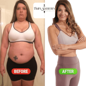 results gallery img 2