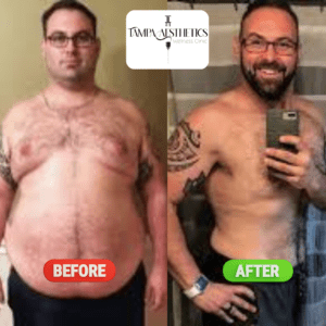 results gallery img 3