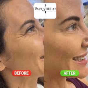 results gallery img 4